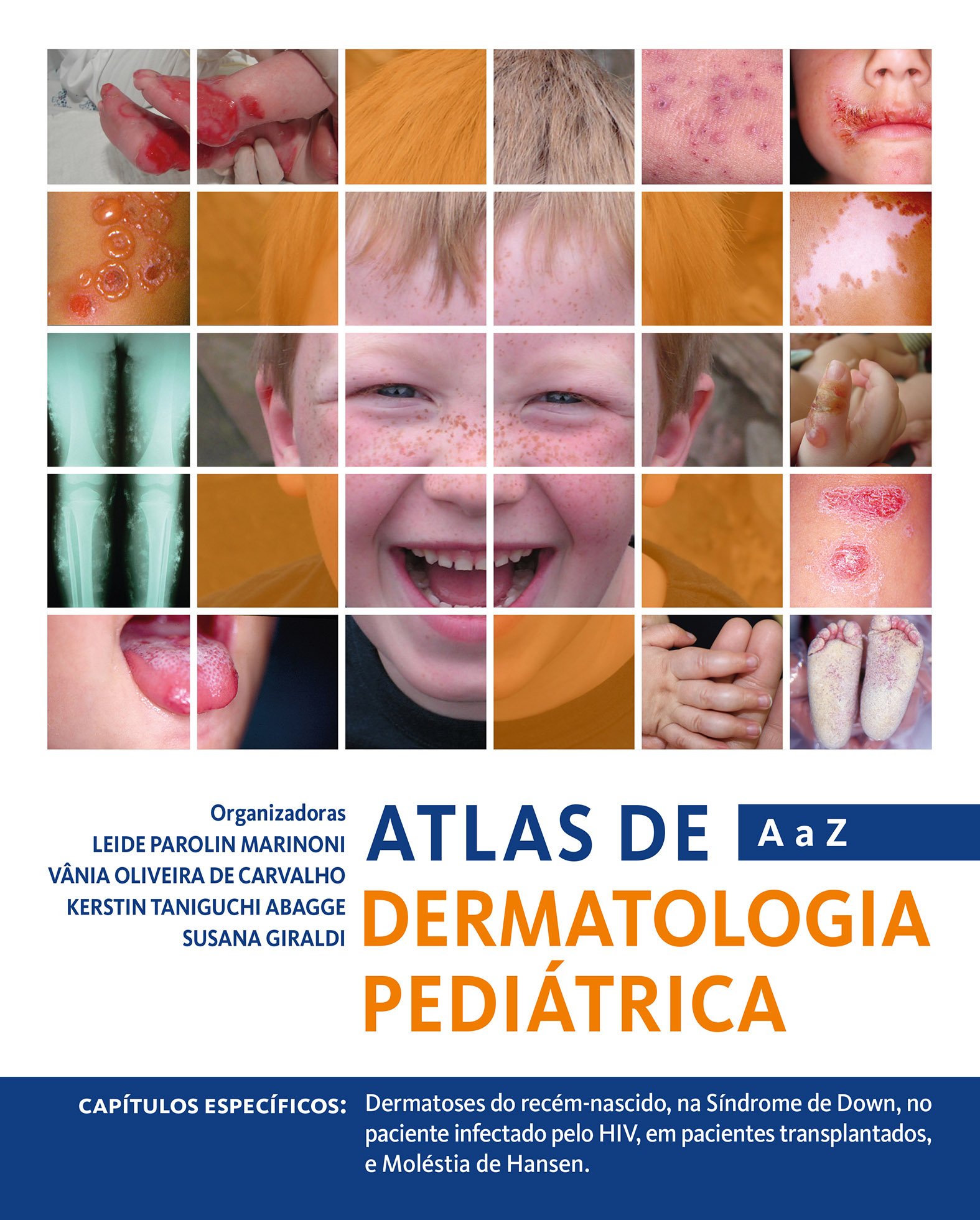 Atlas de Dermatologia Pediátrica de A a Z